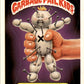 1986 Garbage Pail Kids Series 3 #85b Pinned Lynn No Copyright GD